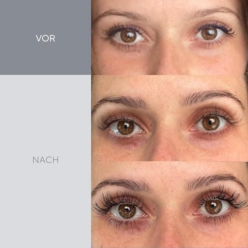 Active Luxe Wimpernserum - Schnelles Wachstum & Dichte Wimpern OHNE Hormone - Vegan & Klinisch Getestet - 1,5 ml  
Activ