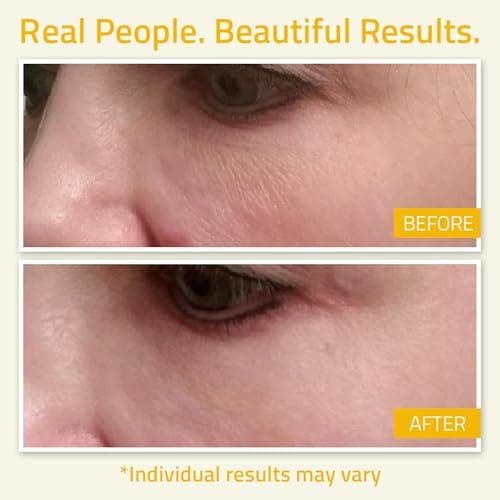YEOUTH Niacinamide Serum für Frauen und Männer Anti Aging mit Hyaluronsäure und Aloe Vera 60ml