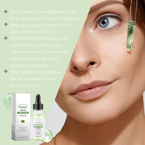 Azelain Serum, Beruhigt Trockene Haut, Verringert PorengrößE Und Hydratisiert